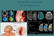 سومین جلسه وبینار تصویربرداری در سکته مغزی حاد در دانشکده پیراپزشکی برگزار خواهد شد
