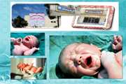 تولد پنج قلوها در بیمارستان جامع بانوان آرش