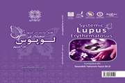 چاب کتابچه  آنچه باید در مورد بیماری لوپوس بدانیم 