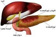 برگزاری کنفرانس پانکراتیت در مرکزآموزشی درمانی سینا