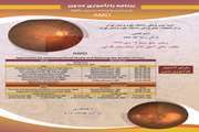 اطلاعیه برگزاری برنامه مدون دژنرانس وابسته به سن ماکولا در بیمارستان فارابی