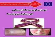 ندای تندرستی/درمان لوپوس با داروهای کورتیکواستروئیدها