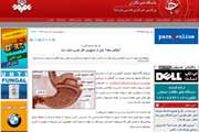 اخبار دانشگاه در رسانه/ یک فوق تخصص گوارش: رفلاکس معده یکی از شایع‌ترین علل شوری دهان است