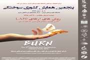 پنجمین همایش کشوری سوختگی در اسفند ماه برگزار می شود