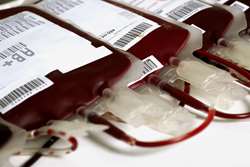 پاسخ به پرسش آیا در مراکز انتقال خون، ضروری است که خون و فرآورده‌های خونی از نظر وجود ویروس کرونا بررسی شوند