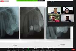 دوره مجازی بین المللی دندانپزشکی مبتنی بر شواهد برگزار شد