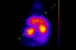 آزمایش یک روش جدید تصویربرداری از متابولیسم کلیه موش در آزمایشگاه پیش‌بالینی