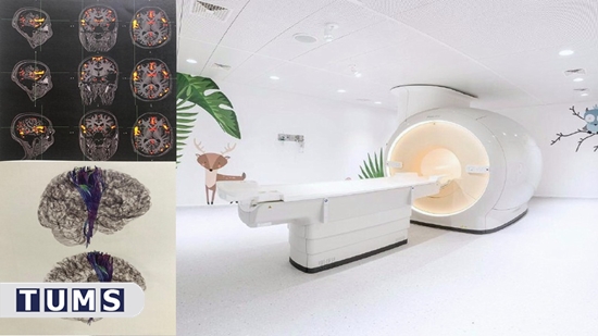 راه‌اندازی neuro advance imaging کودکان در واحد تصویربرداری بیمارستان مرکز طبی کودکان 