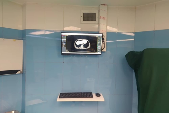 نصب و راه‌اندازی مانیتور در اتاق های عمل برای مشاهده تصاویر دیجیتال رادیولوژی 