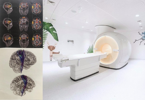 راه‌اندازی neuro advance imaging کودکان در واحد تصویربرداری بیمارستان مرکز طبی کودکان 