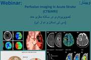 دومین جلسه وبینار تصویربرداری در سکته مغزی حاد در دانشکده پیراپزشکی برگزار خواهد شد