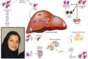 چشم انداز سلولهای بنیادی مزانشیمی مشتق از جفت در بیماری نارسایی حاد کبدی