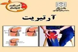 آرتریت