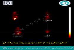 در آزمایشگاه پیش بالینی برای اولین بار حجم تومور و روند پیشرفت آن در فاز پیش بالینی تخمین زده شد